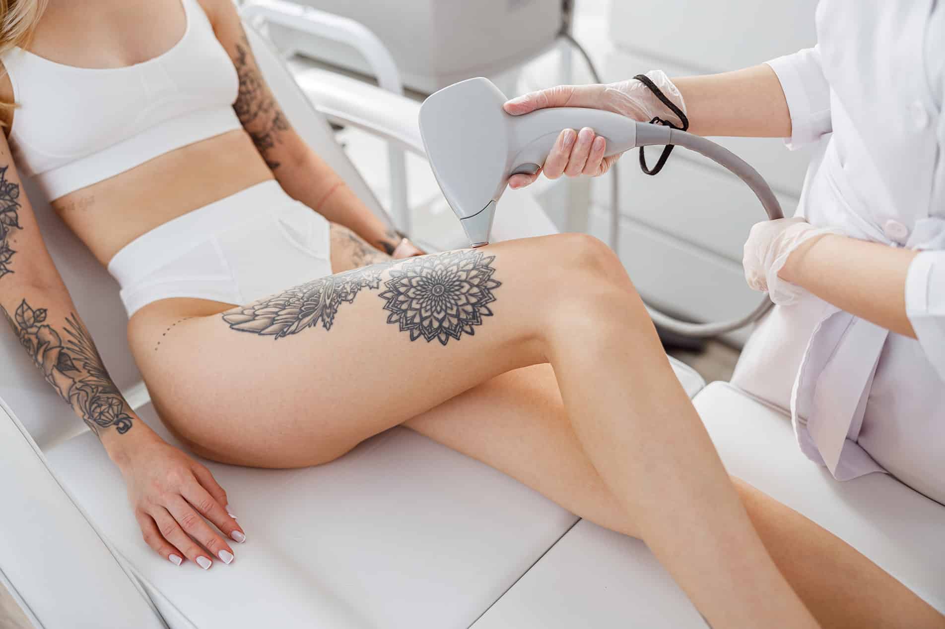 Female beautician performing laser tattoo removal.