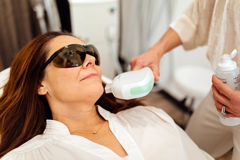 Woman receivign an Erbium Pixel Laser skin resurfacing treatment.