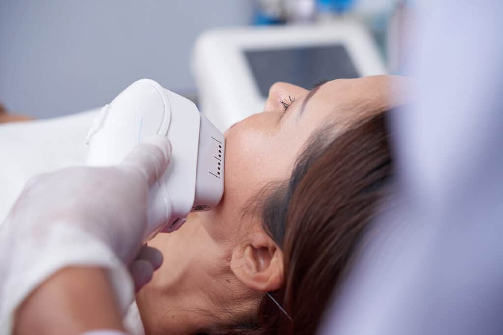 Woman receiving laser hair removal treatment on her face.